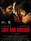 Love and Bruises